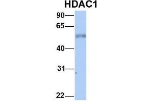 Western Blotting (WB) image for anti-Histone Deacetylase 1 (HDAC1) (Middle Region) antibody (ABIN2779587)
