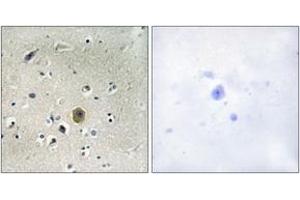 Immunohistochemistry analysis of paraffin-embedded human brain tissue, using MEK1 (Ab-298) Antibody.