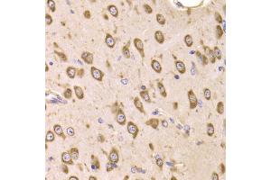 Immunohistochemistry of paraffin-embedded mouse brain using EEF1B2 Antibody (ABIN5973953) at dilution of 1/100 (40x lens). (EEF1B2 antibody)