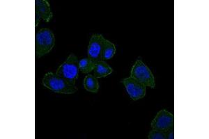 Immunofluorescence analysis of HepG2 cells using HFE mouse mAb (green). (HFE antibody)