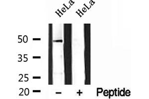 Western blot analysis of extracts of HeLa cells, using DEK antibody. (DEK antibody  (Internal Region))