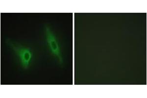 Immunofluorescence analysis of HeLa cells, using CKI-epsilon Antibody. (CK1 epsilon antibody  (AA 276-325))