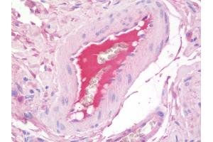 Anti-F2 / Prothrombin / Thrombin antibody IHC staining of human blood plasma. (F2RL2 antibody)