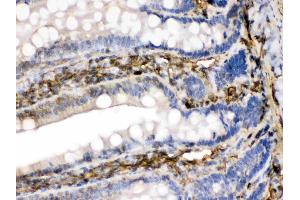 FGF1 was detected in paraffin-embedded sections of rat intestine tissues using rabbit anti- FGF1 Antigen Affinity purified polyclonal antibody (Catalog # ) at 1 µg/mL. (FGF1 antibody  (AA 16-155))