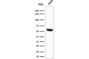 Western Blot Analysis of HeLa cell lysate using HSP60 Monoclonal Antibody (LK1) (HSPD1 antibody)