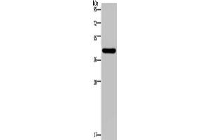 Gel: 10 % SDS-PAGE, Lysate: 40 μg, Lane: Human hepatocellular carcinoma tissue, Primary antibody: (NPHS2 Antibody) at dilution 1/200, Secondary antibody: Goat anti rabbit IgG at 1/8000 dilution, Exposure time: 2 minutes (Podocin antibody)