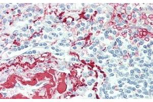Immunohistochemistry (IHC) image for anti-Myeloproliferative Leukemia Virus Oncogene (MPL) (AA 66-260) antibody (ABIN7440170)