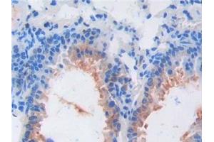 Detection of FGF6 in Mouse Lung Tissue using Polyclonal Antibody to Fibroblast Growth Factor 6 (FGF6) (FGF6 antibody  (AA 39-208))