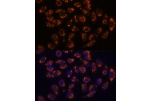 Immunofluorescence analysis of HeLa cells using CRELD1 antibody (ABIN7266621) at dilution of 1:100. (CRELD1 antibody  (AA 50-150))