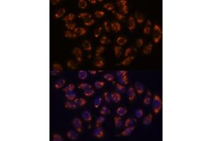 Immunofluorescence analysis of HeLa cells using CRELD1 antibody (ABIN7266621) at dilution of 1:100. (CRELD1 antibody  (AA 50-150))