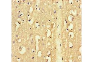 Immunohistochemistry of paraffin-embedded human brain tissue using ABIN7171786 at dilution of 1:100 (FAM46C antibody  (AA 1-391))