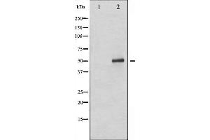 Western blot analysis of p53 phosphorylation expression in Etoposide treated 293 whole cell lysates,The lane on the left is treated with the antigen-specific peptide.