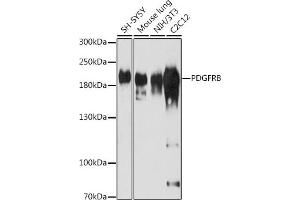 Western blot analysis of extracts of various cell lines, using PDGFRB antibody (ABIN3023138, ABIN3023139, ABIN3023140 and ABIN6219408) at 1:1000 dilution.