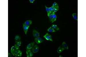 Immunofluorescence staining of Hela cells with ABIN7127774 at 1:36, counter-stained with DAPI. (Recombinant PRKAR1A antibody)