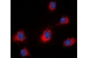 Immunofluorescent analysis of MID1 staining in HeLa cells. (MID1 antibody  (N-Term))
