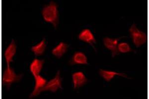 ABIN6266963 staining K562 by IF/ICC. (Epsin 1 antibody)