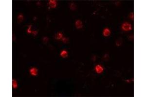 Immunofluorescencent staining of Daudi cells with CD244 polyclonal antibody  at 20 ug/mL.