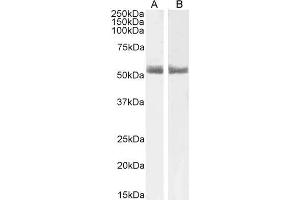 ABIN185366 (1µg/ml) staining of Human Breast (A) and Breast cancer (B) lysate (35µg protein in RIPA buffer). (Retinoic Acid Receptor alpha antibody  (C-Term))