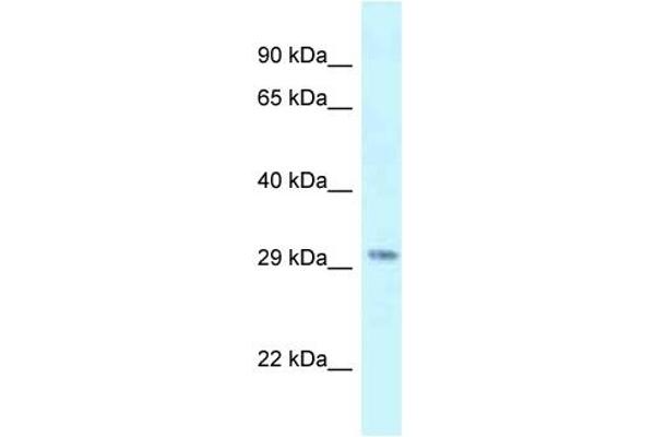 SUV420H1 antibody  (C-Term)
