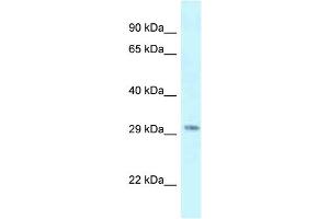 Antibody Titration: 1. (SUV420H1 antibody  (C-Term))