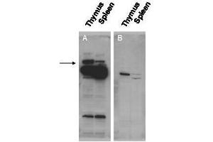 Western blot using  affinity purified anti-Pogz antibody shows detection of Pogz protein (arrowhead) in adult mouse thymus and spleen tissue lysate (Panel A).