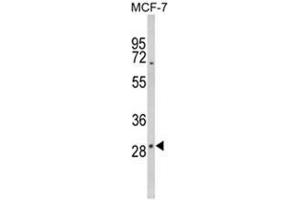 Western blot analysis of DIO2 Antibody (Center) in MCF-7 cell line lysates (35ug/lane). (DIO2 antibody  (Middle Region))