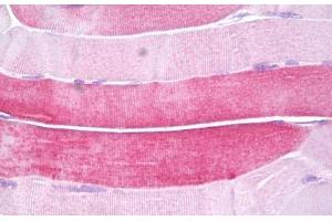 Anti-HSPB6 antibody IHC staining of human skeletal muscle. (HSPB6 antibody  (AA 5-54))
