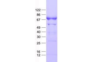 Validation with Western Blot (NXF2 Protein (His tag))