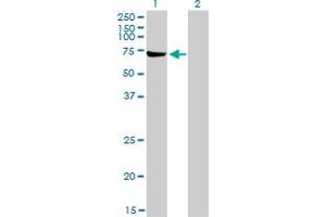 Western Blotting (WB) image for anti-ATP-Binding Cassette, Sub-Family F (GCN20), Member 2 (ABCF2) (AA 1-110) antibody (ABIN564348)