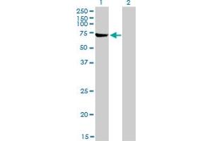 Western Blot analysis of ABCF2 expression in transfected 293T cell line by ABCF2 monoclonal antibody (M01), clone 1D11. (ABCF2 antibody  (AA 1-110))