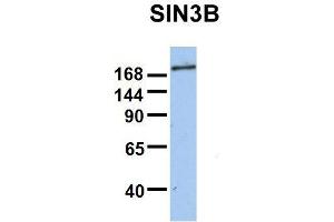 Host:  Rabbit  Target Name:  SIN3B  Sample Type:  Human Fetal Brain  Antibody Dilution:  1. (SIN3B antibody  (Middle Region))