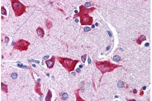 Brain, cortex (NMUR2 antibody  (N-Term))