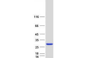 Validation with Western Blot
