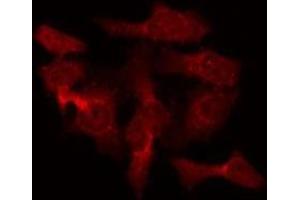 ABIN6275469 staining Hela by IF/ICC. (RAB40B antibody  (C-Term))