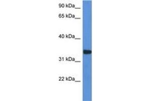 Image no. 1 for anti-Holocytochrome C Synthase (HCCS) (AA 194-243) antibody (ABIN6746937) (HCCS antibody  (AA 194-243))