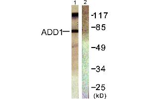 Western blot analysis of extracts from Hela cells treated with Forskolin (40nM, 30min), using ADD1 (Ab-726) antibody (#B0002, Line 1 and 2).