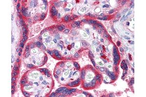 Anti-ADAM15 antibody IHC of human placenta. (ADAM15 antibody  (AA 1-225))