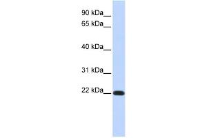 WB Suggested Anti-FXYD5 Antibody Titration:  0. (FXYD5 antibody  (Middle Region))