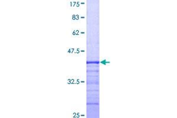 Dystroglycan Protein (AA 31-140) (GST tag)