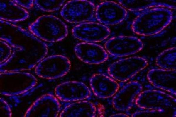 O3FAR1 antibody