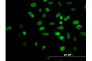 Image no. 7 for anti-V-Akt Murine Thymoma Viral Oncogene Homolog 2 (AKT2) (AA 100-189) antibody (ABIN599349) (AKT2 antibody  (AA 100-189))