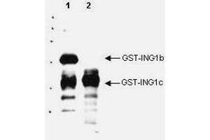 Western blot analysis is shown using  Affinity Purified anti-p33 ING1 antibody to detect over expressed Human ING1 present in cell nuclear extracts. (ING1 antibody  (AA 275-300))