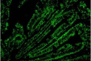 Immunofluorescence analysis of Mouse colonic tissue with CD4 Monoclonal Antibody. (CD4 antibody)