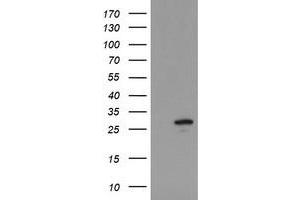 Image no. 1 for anti-Ubiquitin-Conjugating Enzyme E2S (UBE2S) antibody (ABIN1501646)