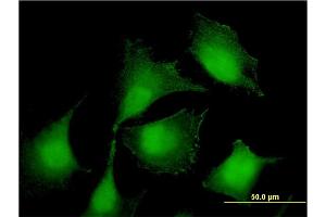 Immunofluorescence of monoclonal antibody to RIOK2 on HeLa cell. (RIOK2 antibody  (AA 453-551))