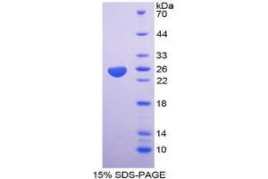 SDS-PAGE analysis of Mouse HABP1 Protein.