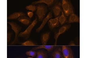 Immunofluorescence analysis of U-2 OS cells using SHMT1 Polyclonal Antibody at dilution of 1:100. (SHMT1 antibody)