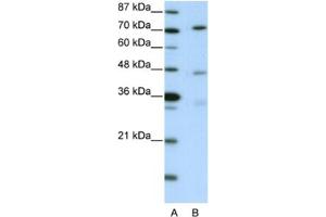 Western Blotting (WB) image for anti-Autophagy related 4B Cysteine Peptidase (ATG4B) antibody (ABIN2460952) (ATG4B antibody)