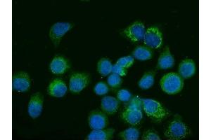IF analysis of Glutaminase/GLS using anti-Glutaminase/GLS antibody (ABIN7601601). (Glutaminase antibody  (AA 396-654))