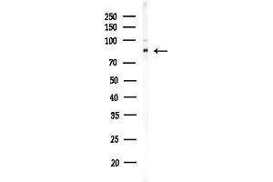 anti-Chloride Channel Kb (CLCNKB) (N-Term) antibody